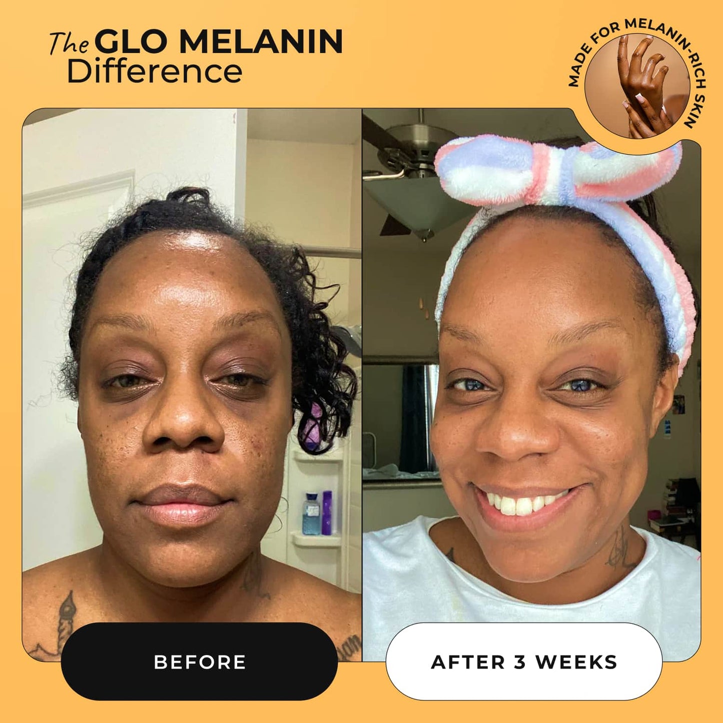 Glass Skin Face Kit - Glo Melanin
