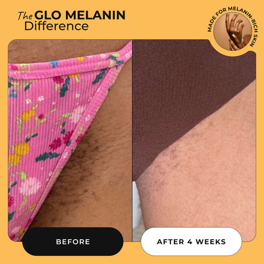 Goddess Yoni Oil - Glo Melanin