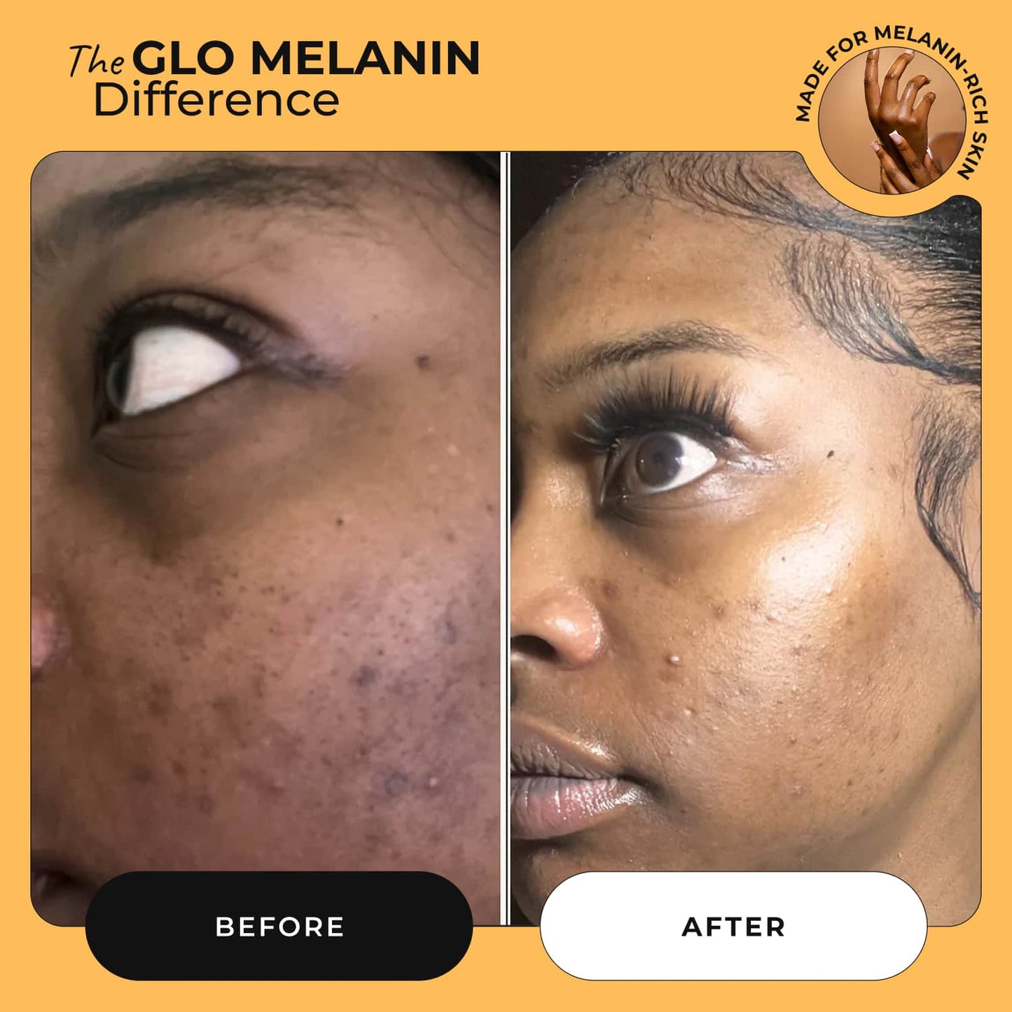 Head to Toe Bundle - Glo Melanin