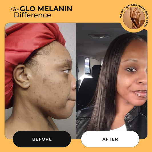 Rose Glo Oil - Glo Melanin