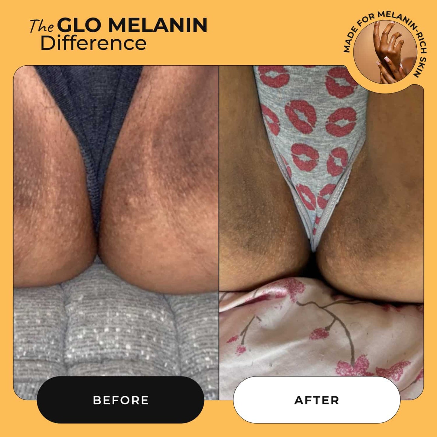 Yoni Wellness Kit - Glo Melanin