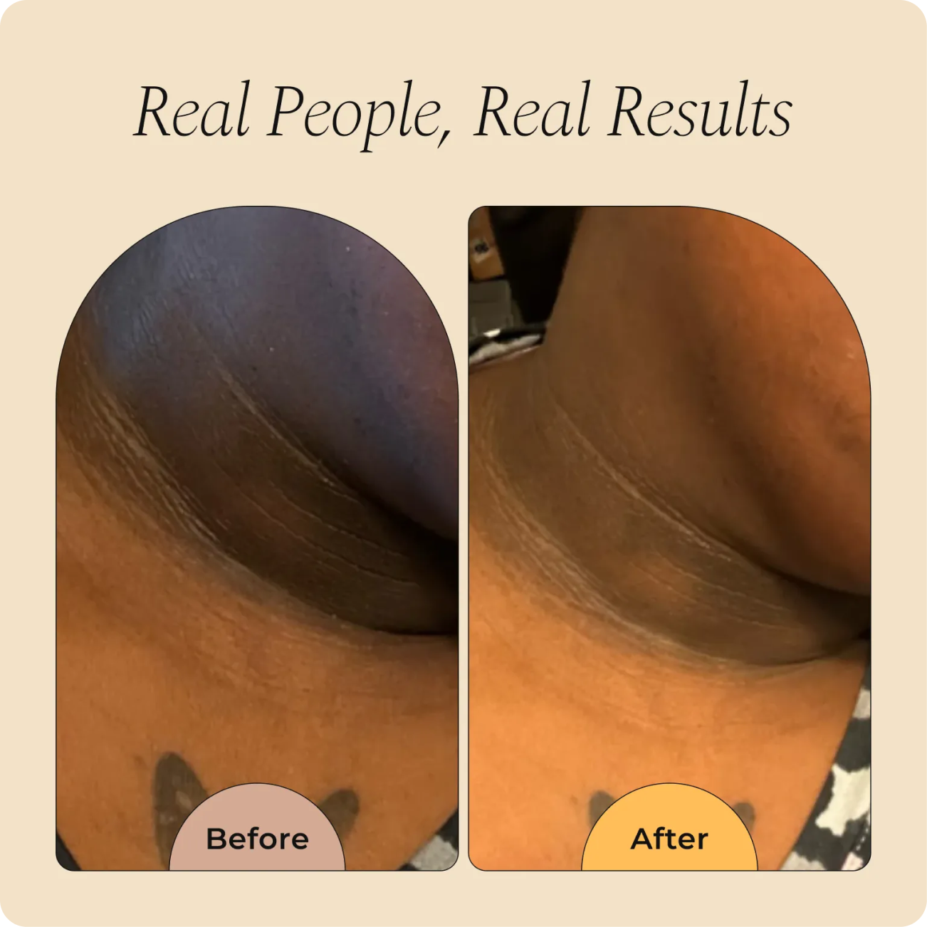 Magic Eraser Cream Limited Offer