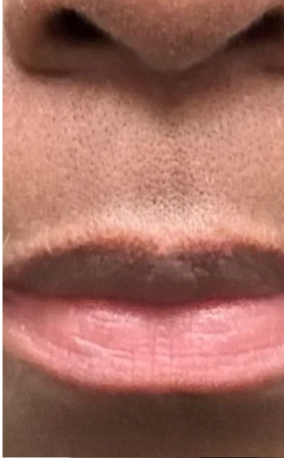 Before and After