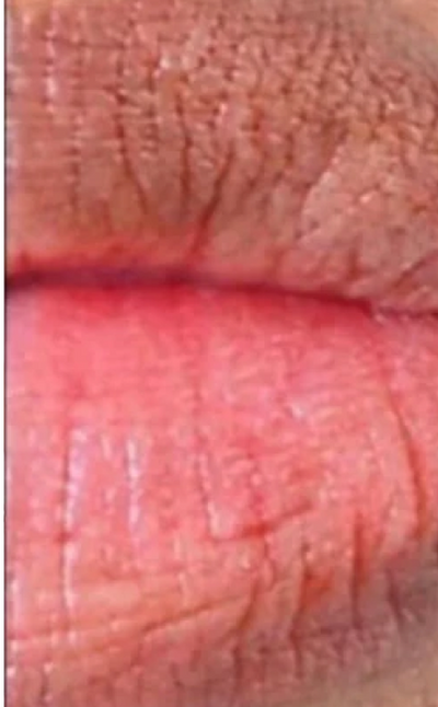 Before and After