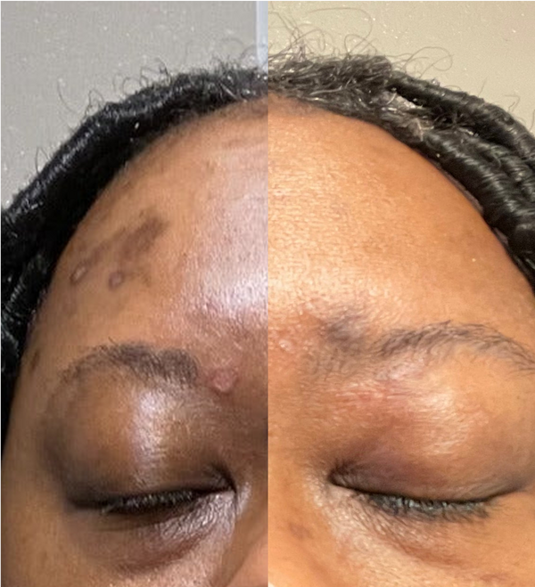 Before After Image