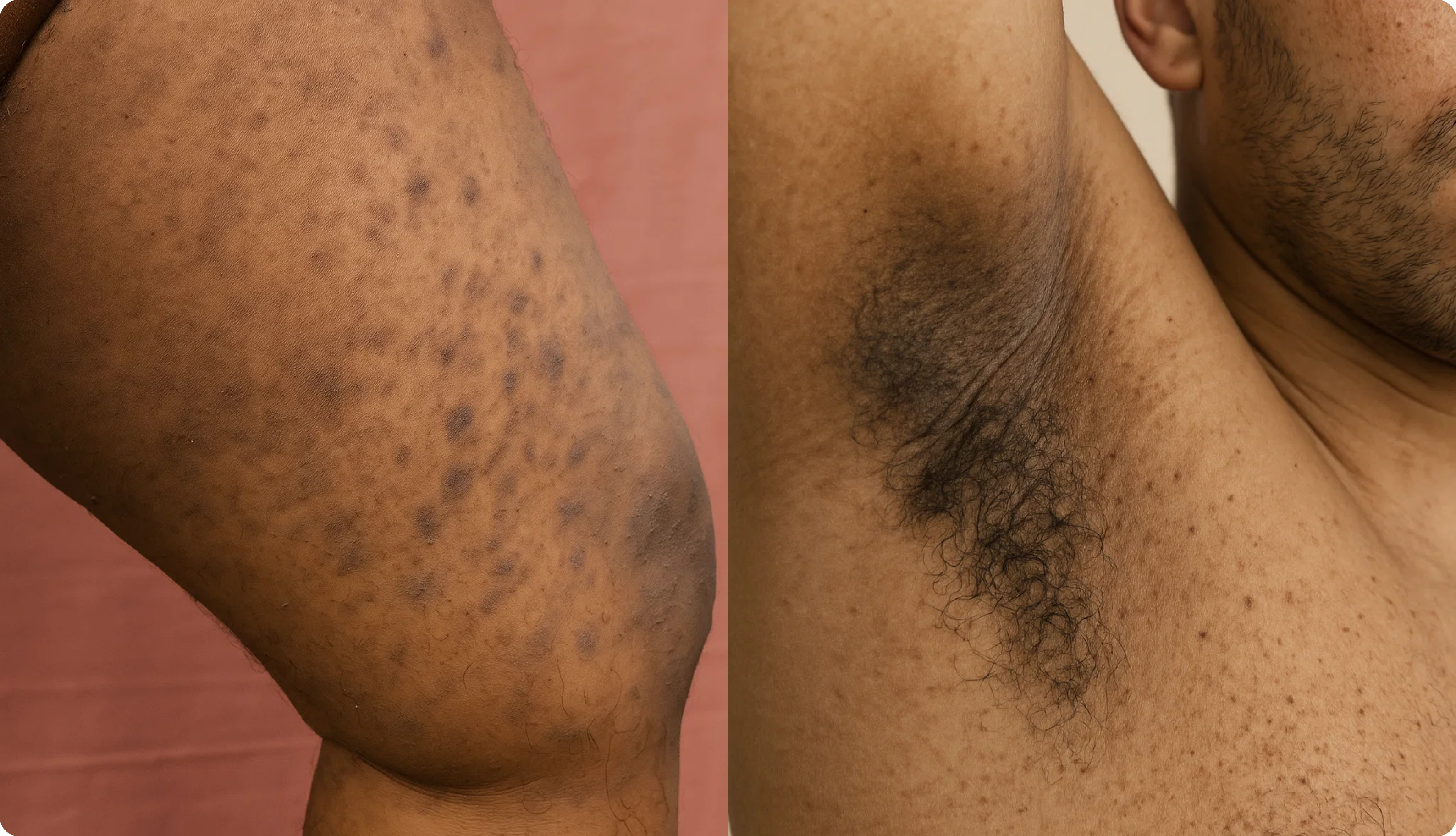 Comparison Image