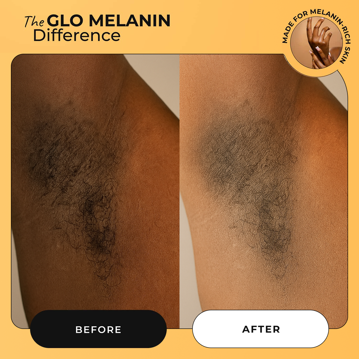 Melanin Skin Bundle   (40% off)