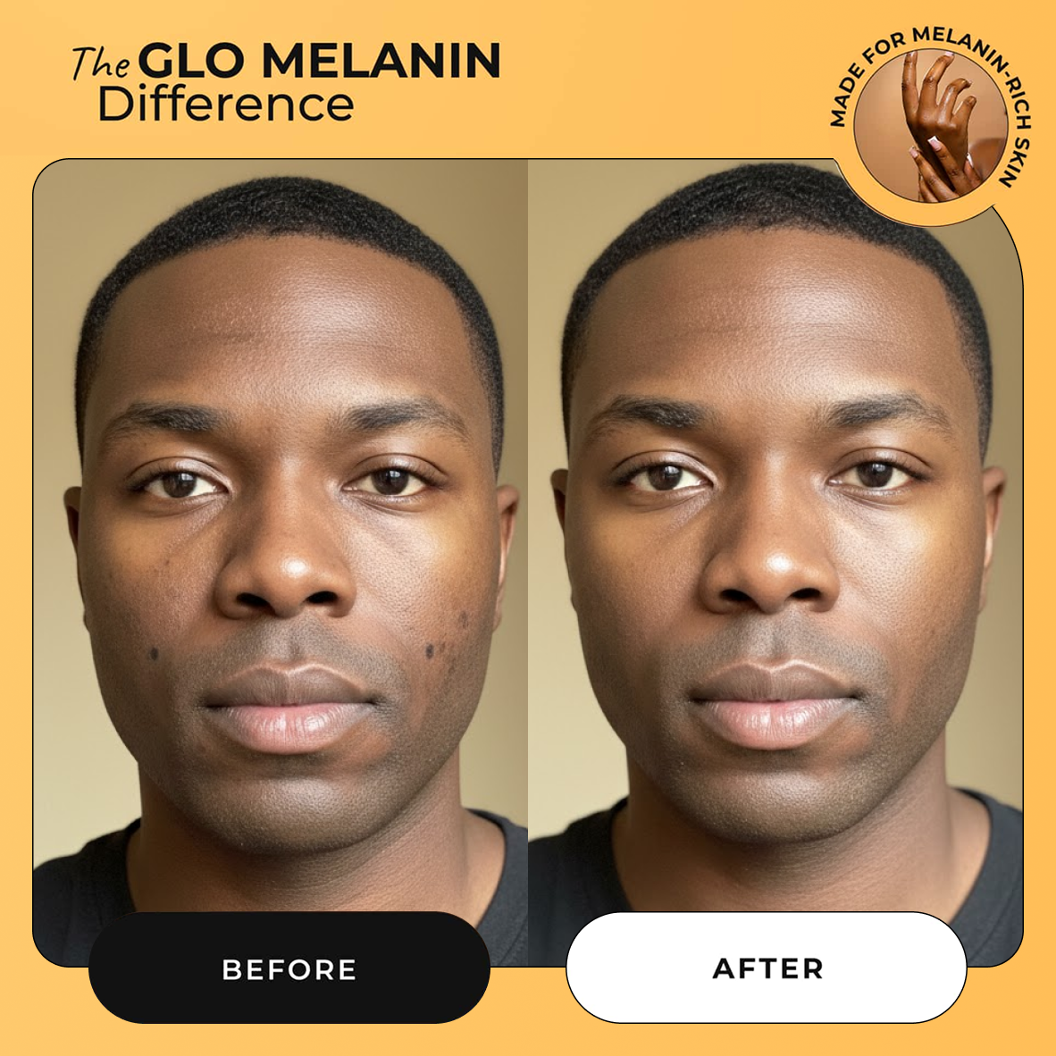 Melanin Skin Bundle   (40% off)