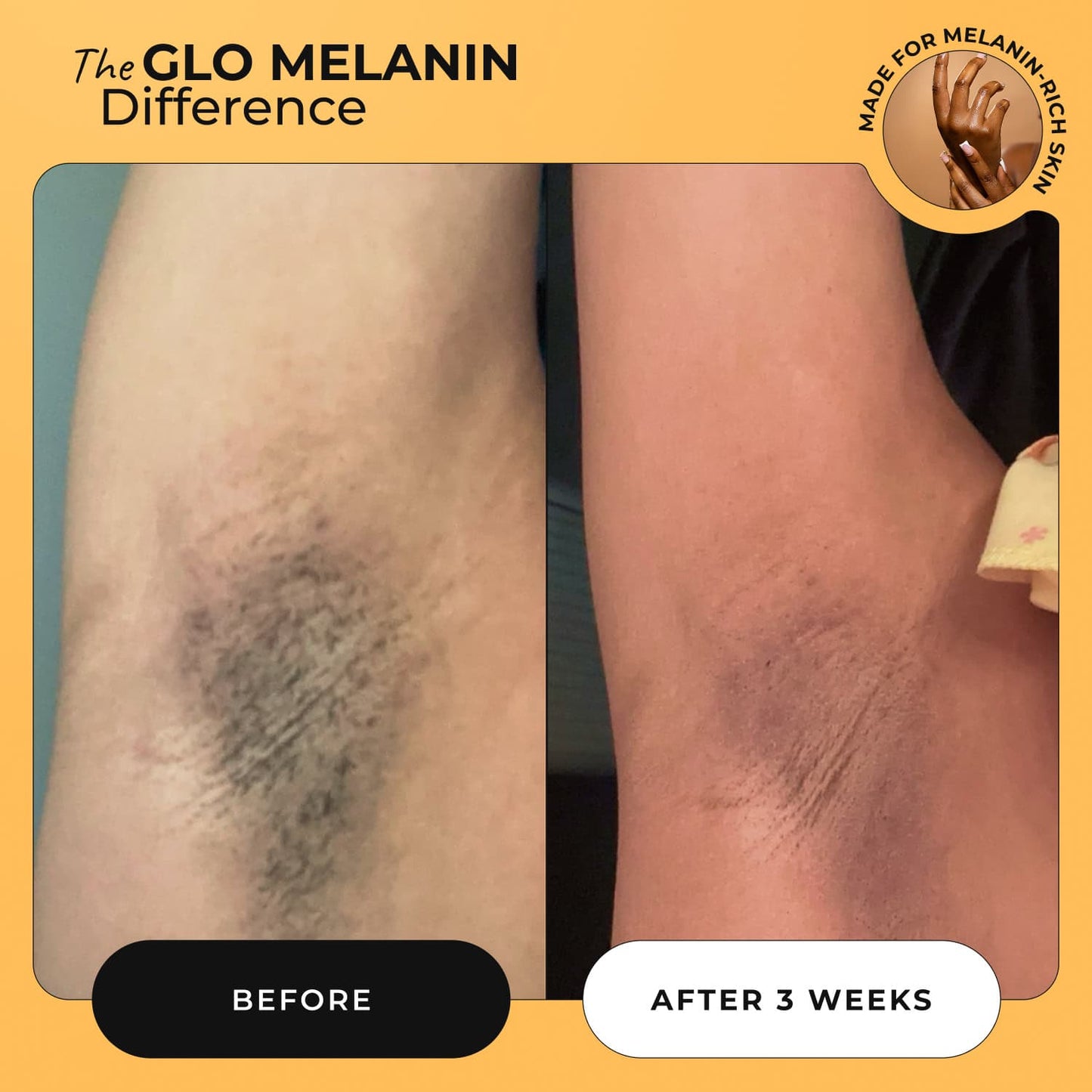 Turmeric Dark Spot Removal Scrub - Glo Melanin