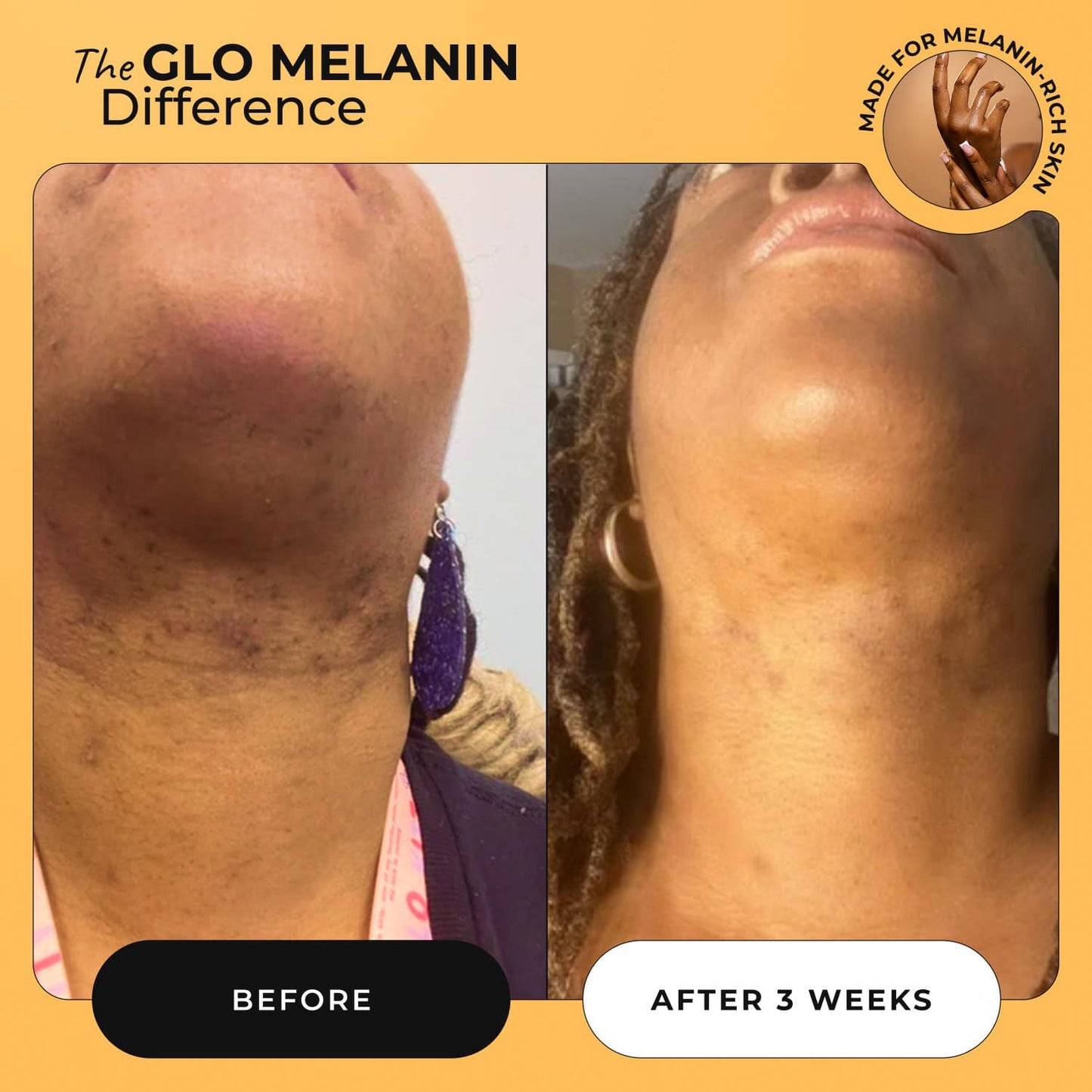 Turmeric Dark Spot Removal Scrub - Glo Melanin