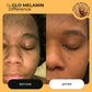 Body Brightening Bundle - Glo Melanin