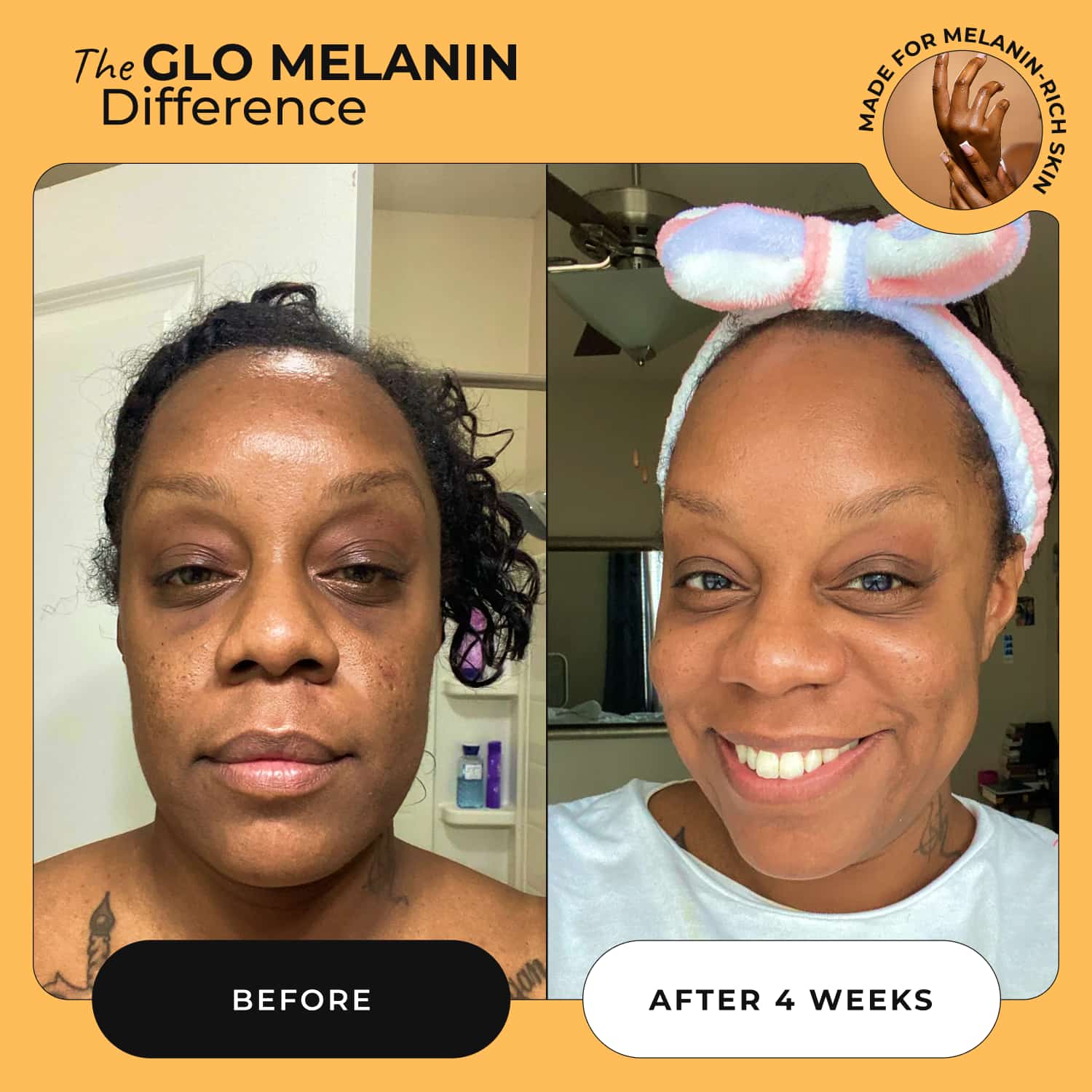 Brightening Duo - Glo Melanin