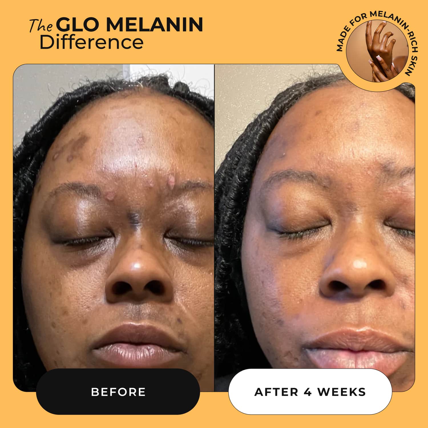 Glass Skin Face Kit - Glo Melanin