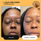 Glass Skin Face Kit - Glo Melanin