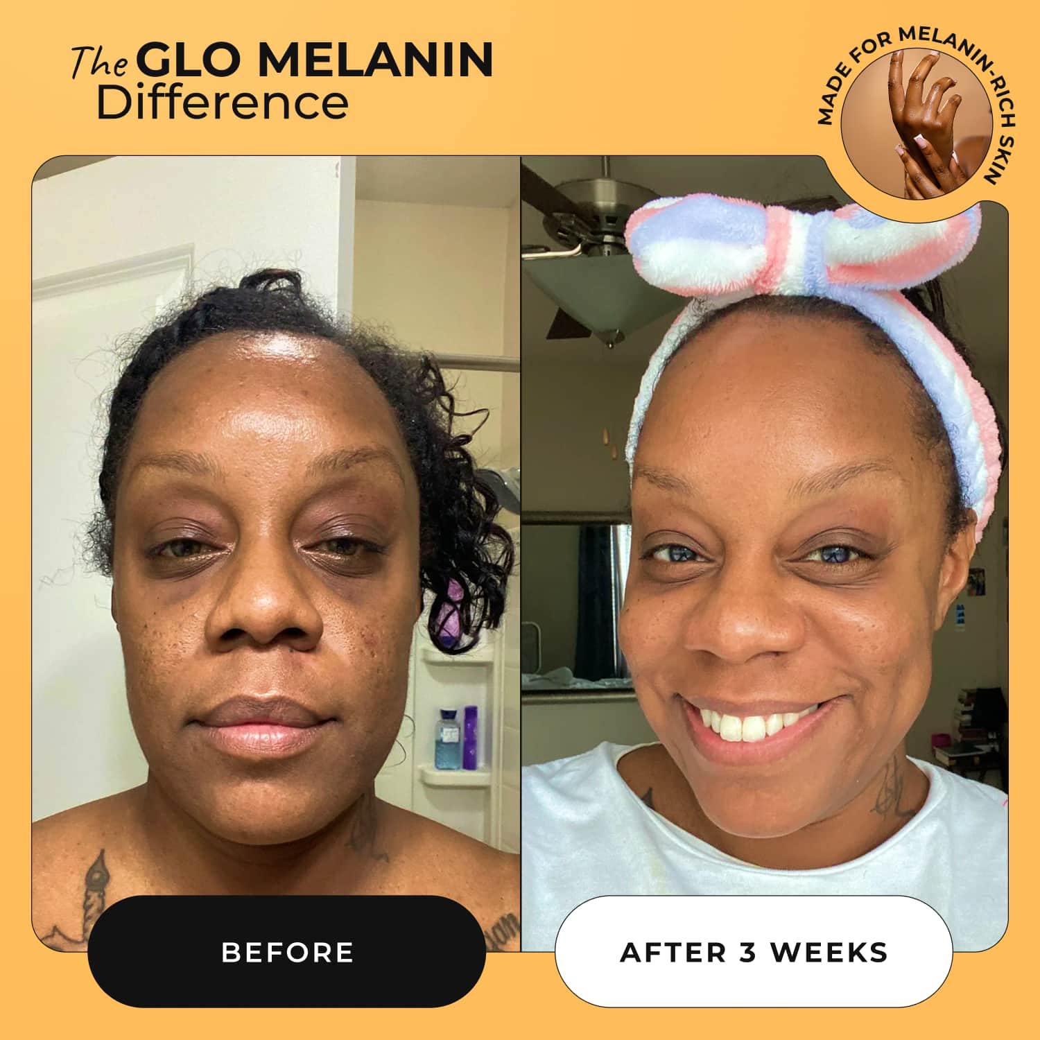 Glass Skin Face Kit - Glo Melanin