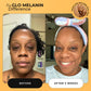 Glass Skin Face Kit - Glo Melanin