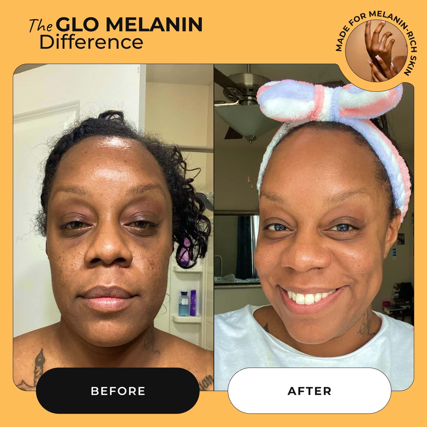 Head to Toe Bundle - Glo Melanin