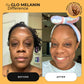 Head to Toe Bundle - Glo Melanin
