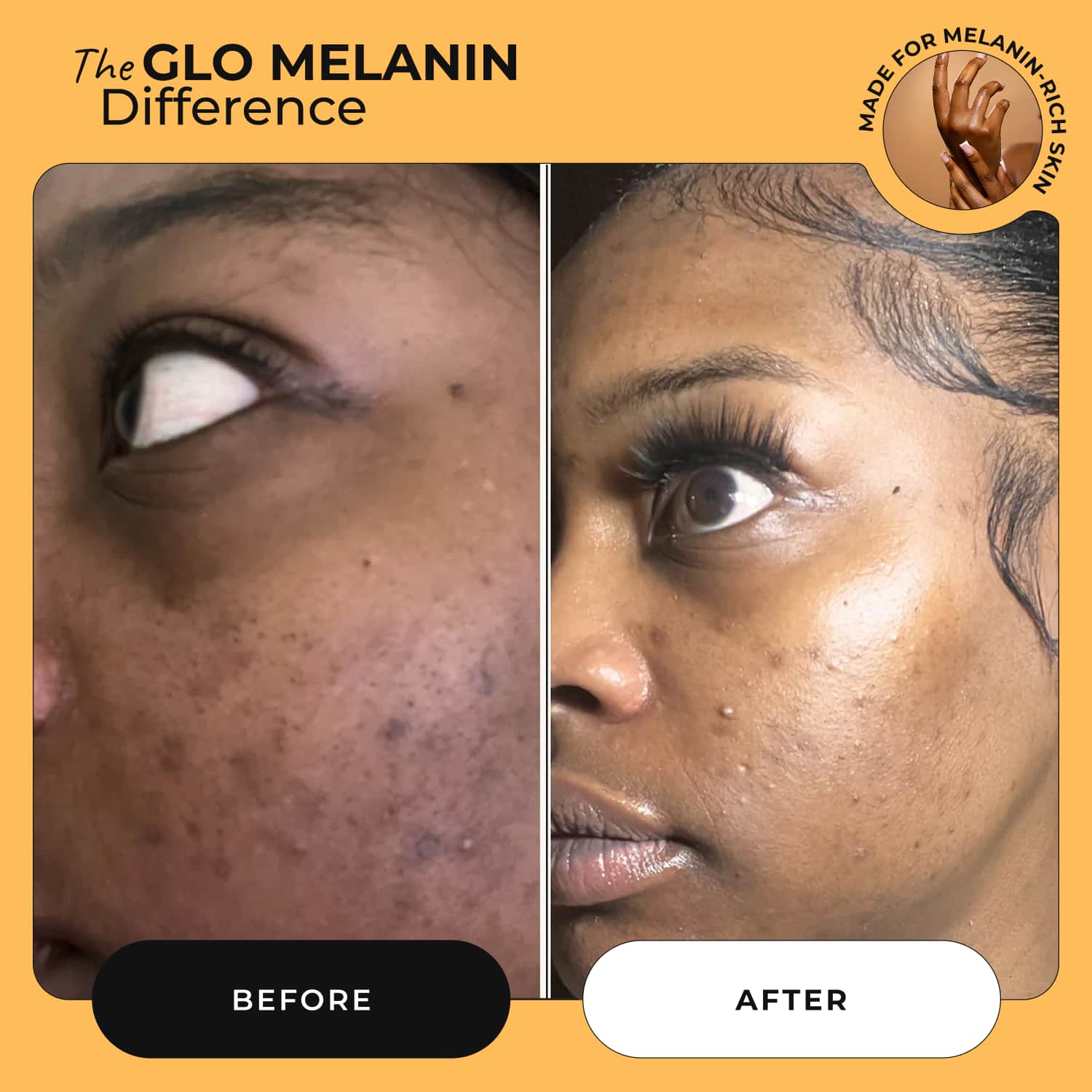 Head to Toe Bundle - Glo Melanin