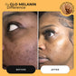 Head to Toe Bundle - Glo Melanin