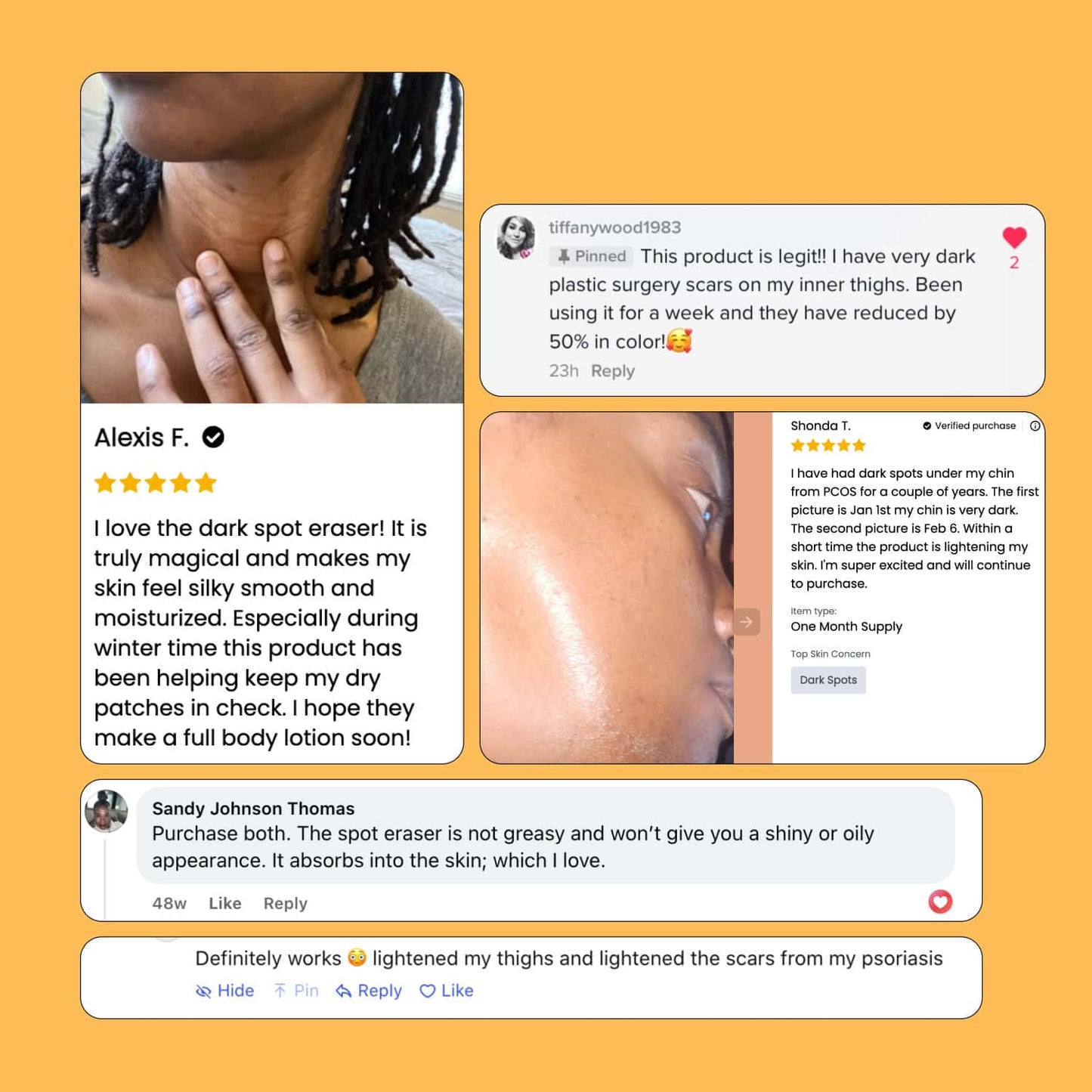 Magic Eraser Dark Spot Cream - Glo Melanin