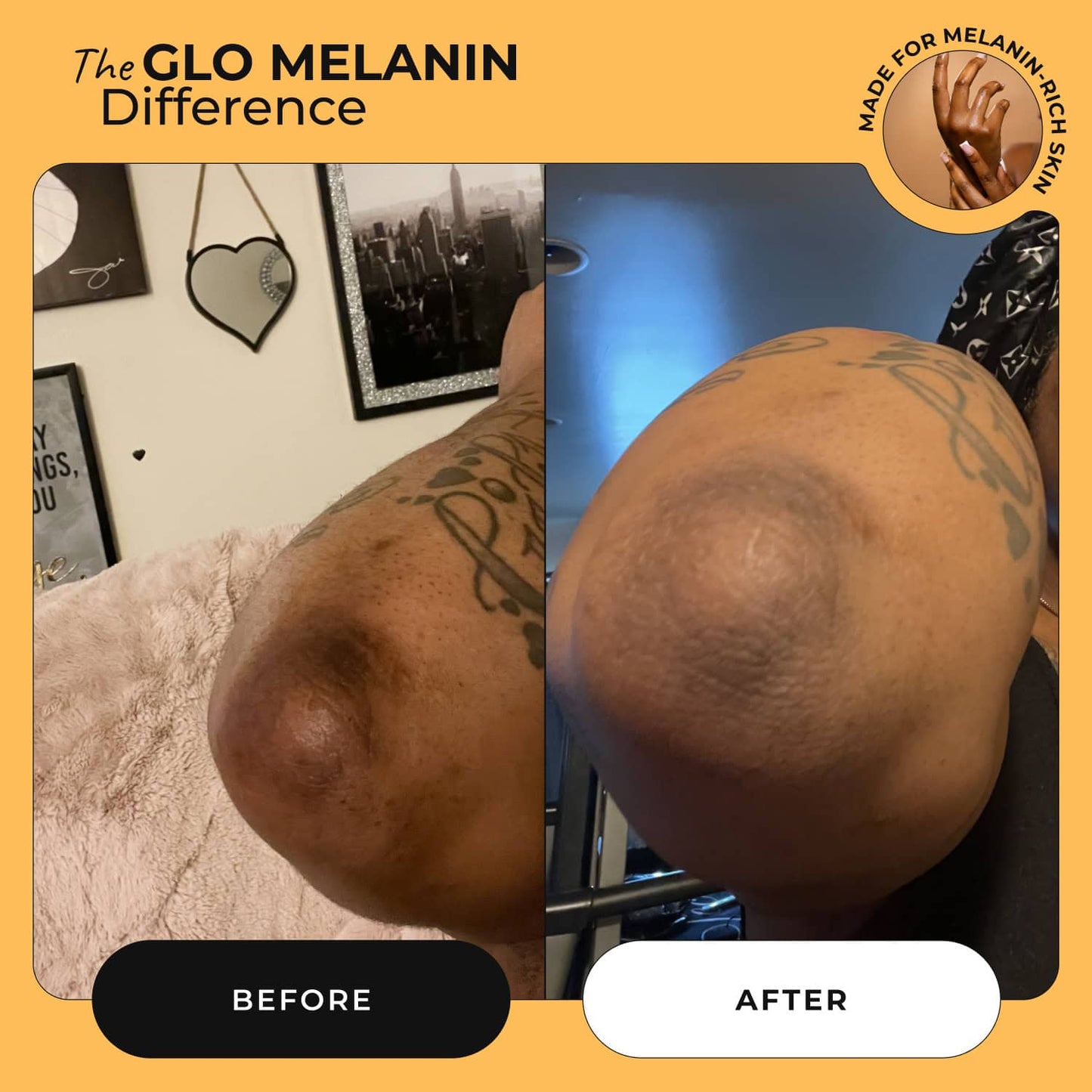 Magic Eraser Dark Spot Cream - Glo Melanin