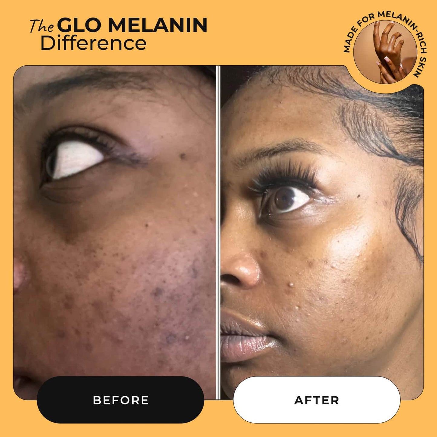 Nourishing and Brightening Face Cream - Glo Melanin