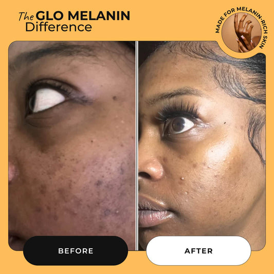 Nourishing and Brightening Face Cream - Glo Melanin