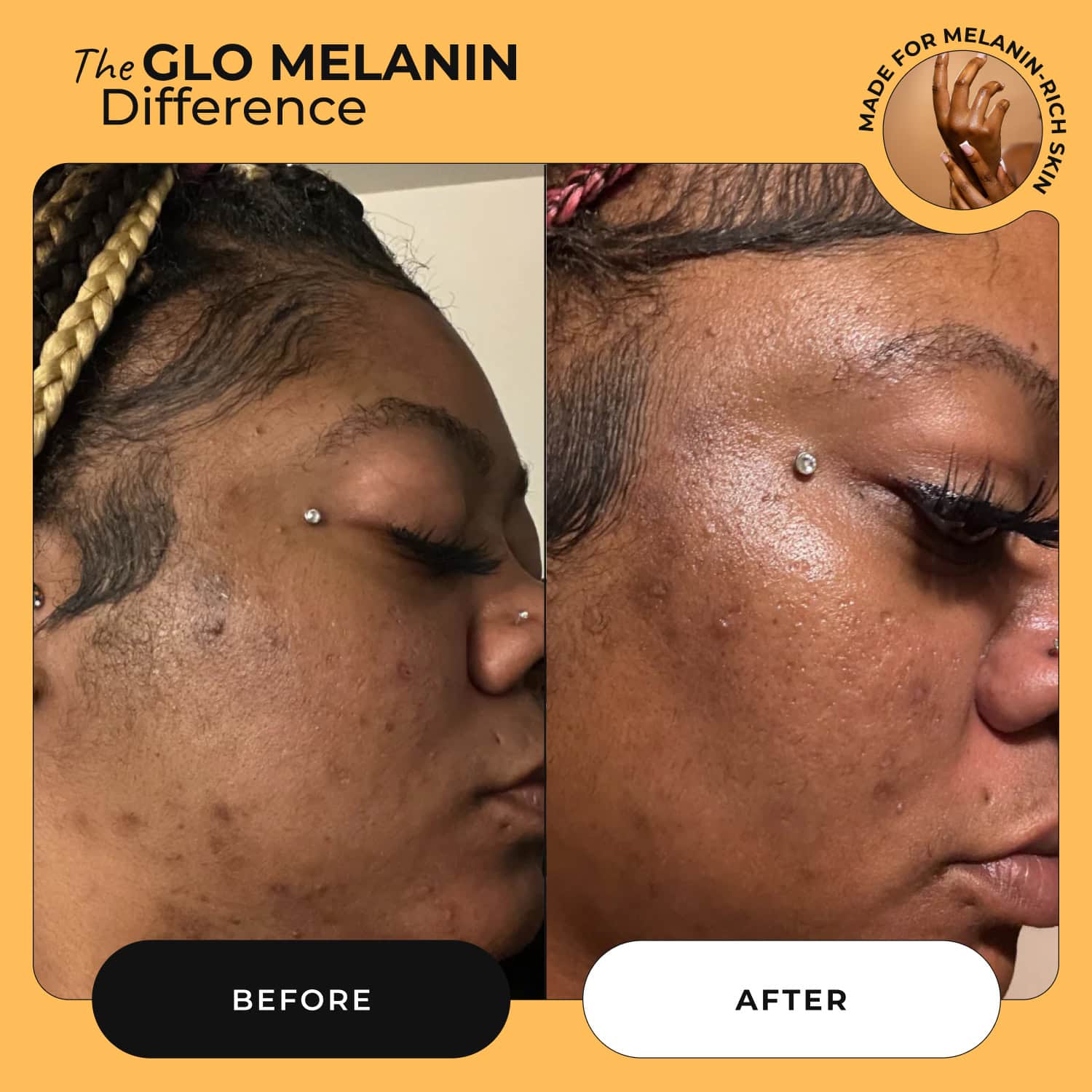Raw Manuka Honey and Turmeric Face Wash - Glo Melanin