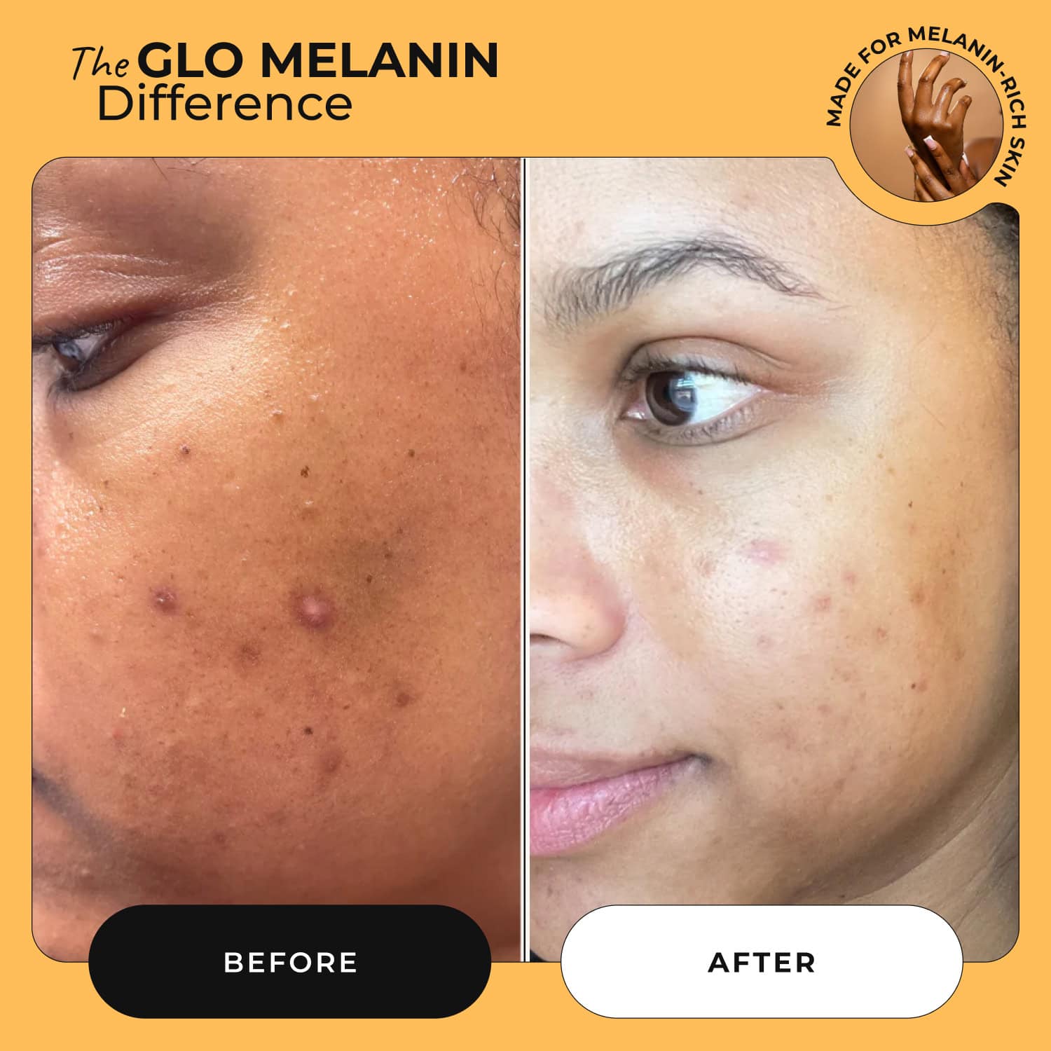 Rose Glo Oil - Glo Melanin