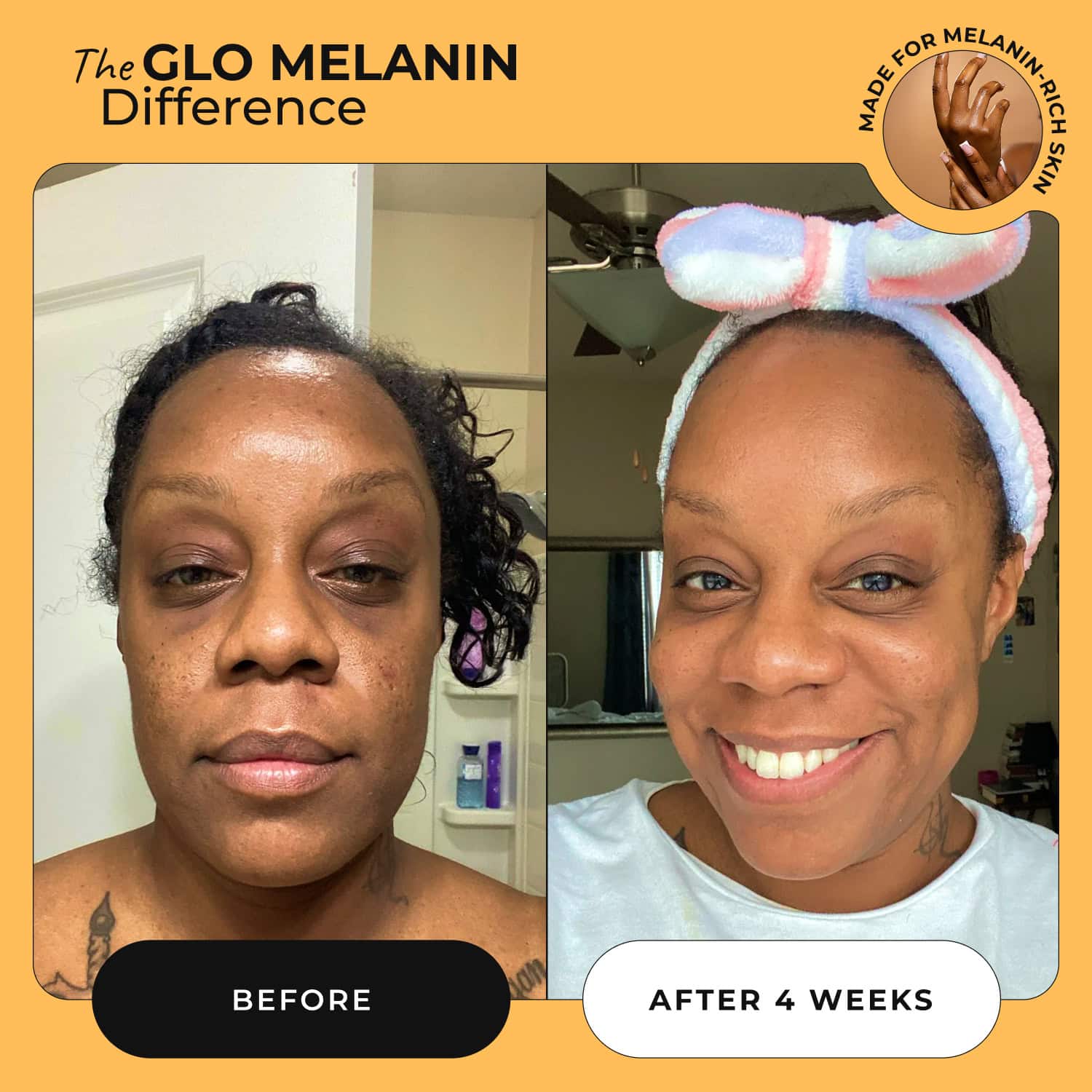Turmeric Brightening Soap (with Vitamin C, Alpha Arbutin, Oat) - Glo Melanin