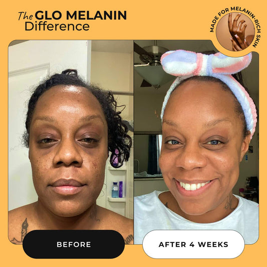 Turmeric Brightening Soap (with Vitamin C, Alpha Arbutin, Oat) - Glo Melanin