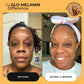 Turmeric Brightening Soap (with Vitamin C, Alpha Arbutin, Oat) - Glo Melanin