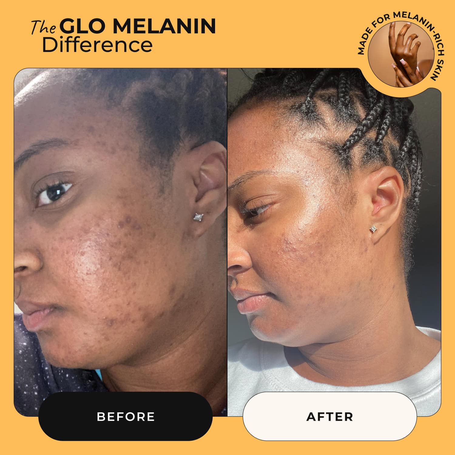 Turmeric and Kojic Foaming Face Wash - Glo Melanin