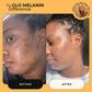 Turmeric and Kojic Foaming Face Wash - Glo Melanin