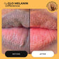 Turmeric and Lemon Lip Balm (for Dark Lips) - Glo Melanin