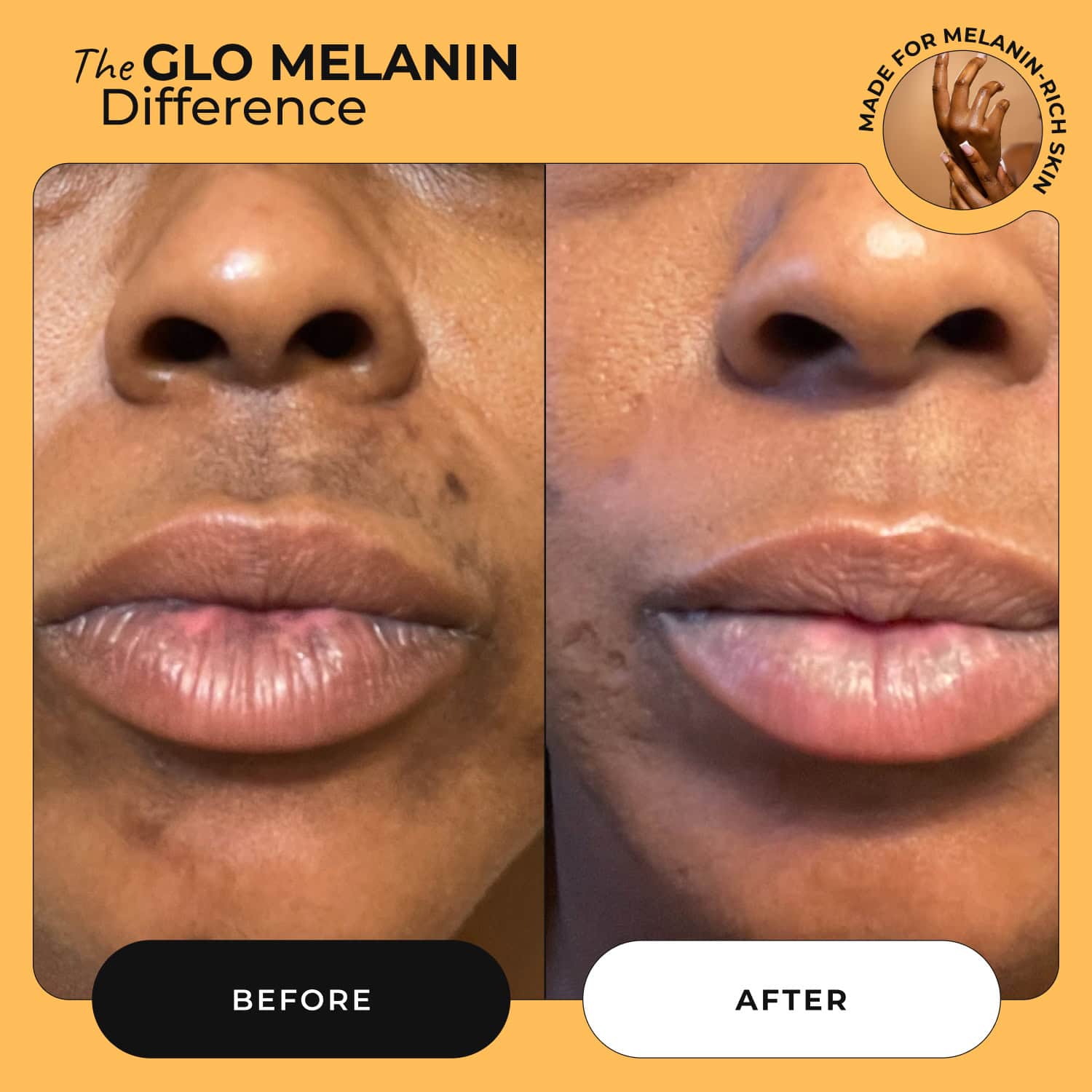 Turmeric and Lemon Lip Balm (for Dark Lips) - Glo Melanin