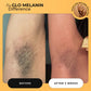 Yoni Wellness Kit - Glo Melanin