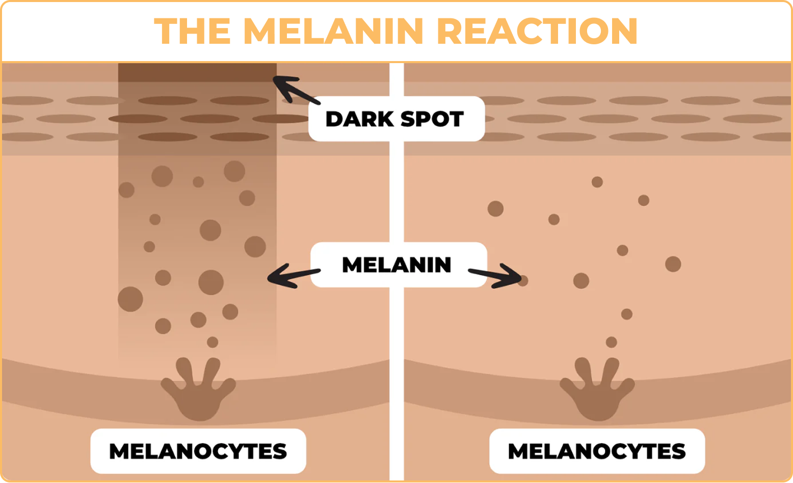 The Melanin Reaction Diagram