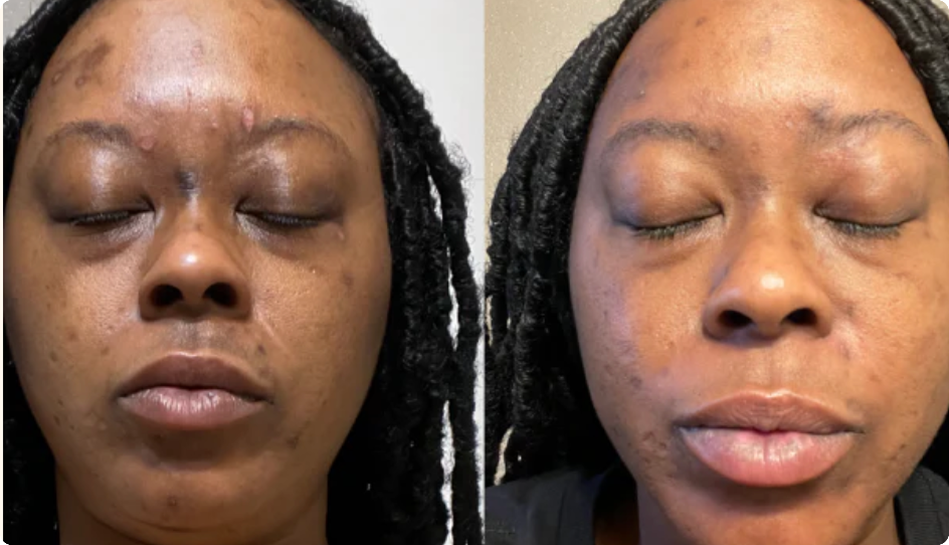 Comparison Image