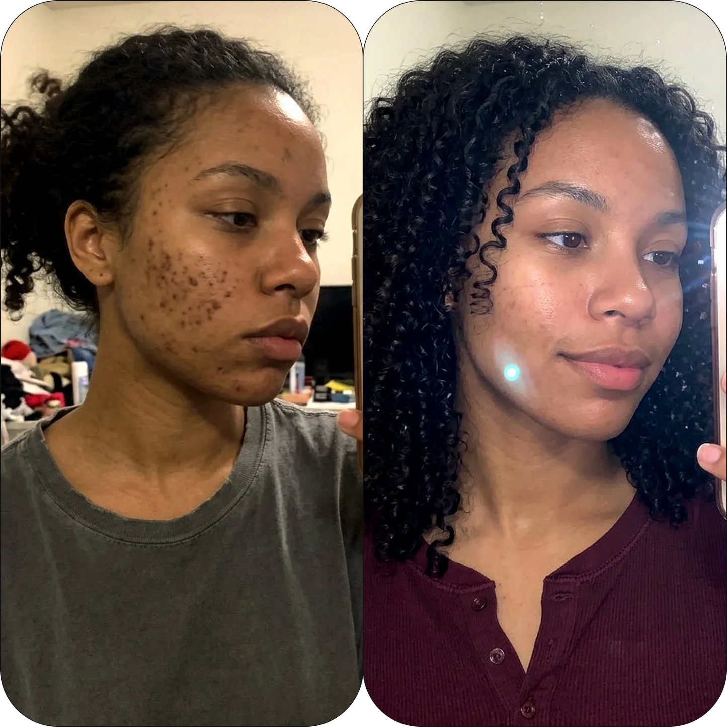 Sea Moss Wrapping Mask with Turmeric & Kojic Acid