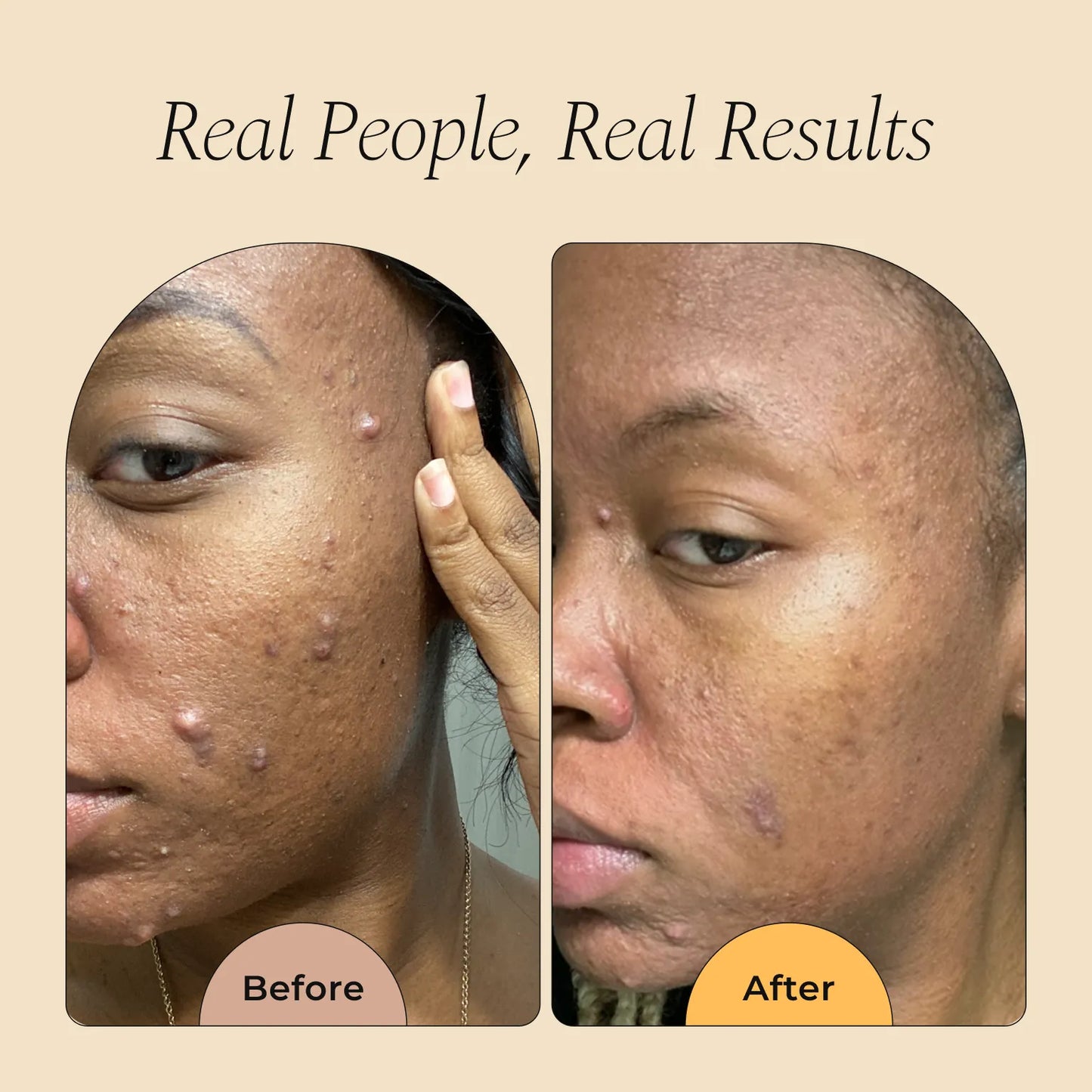 Turmeric and Kojic Foaming Face Wash