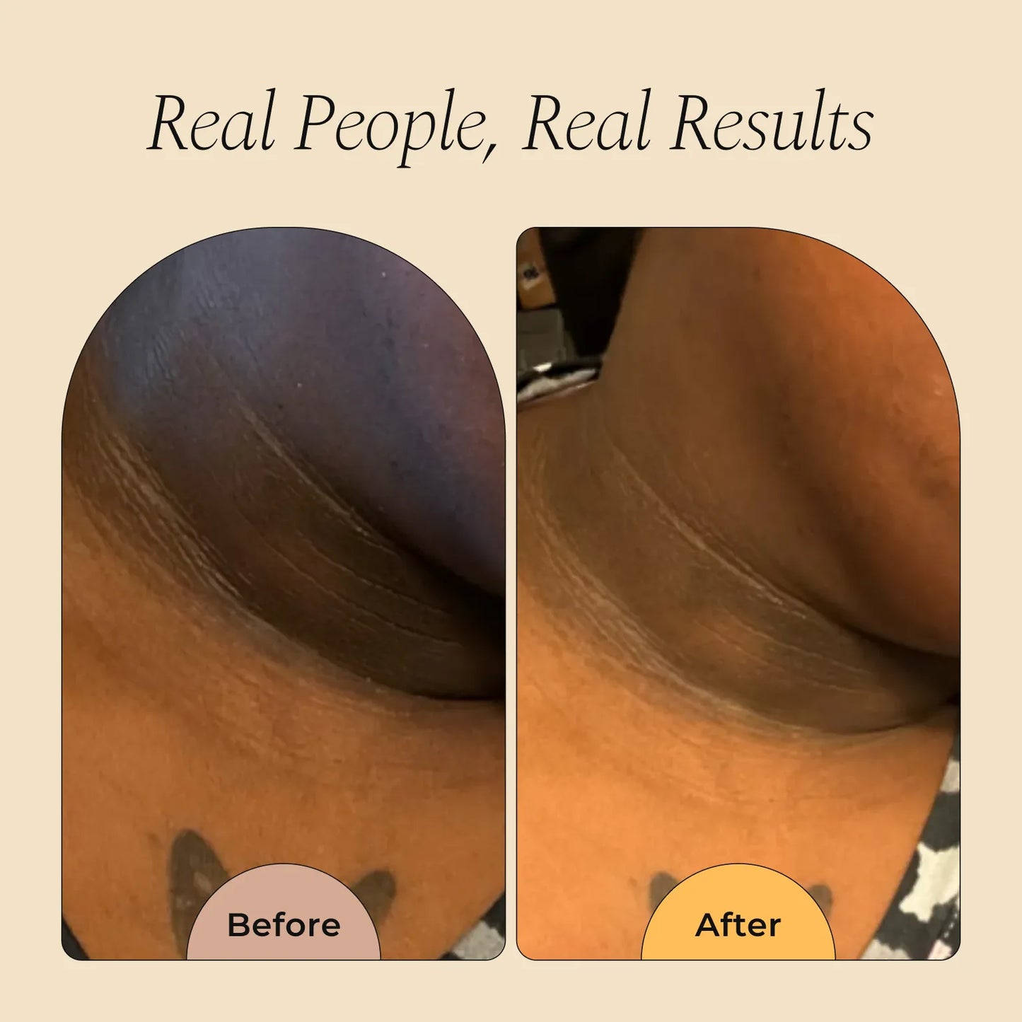 Magic Eraser Dark Spot Cream