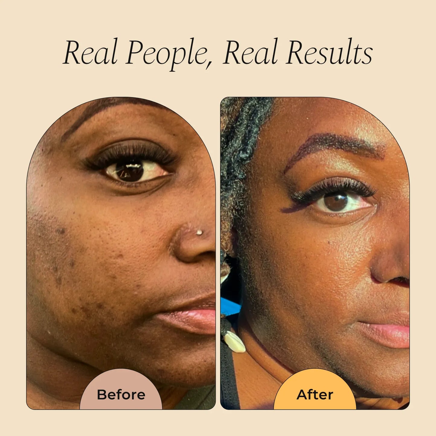 Turmeric Dark Spot Removal Scrub