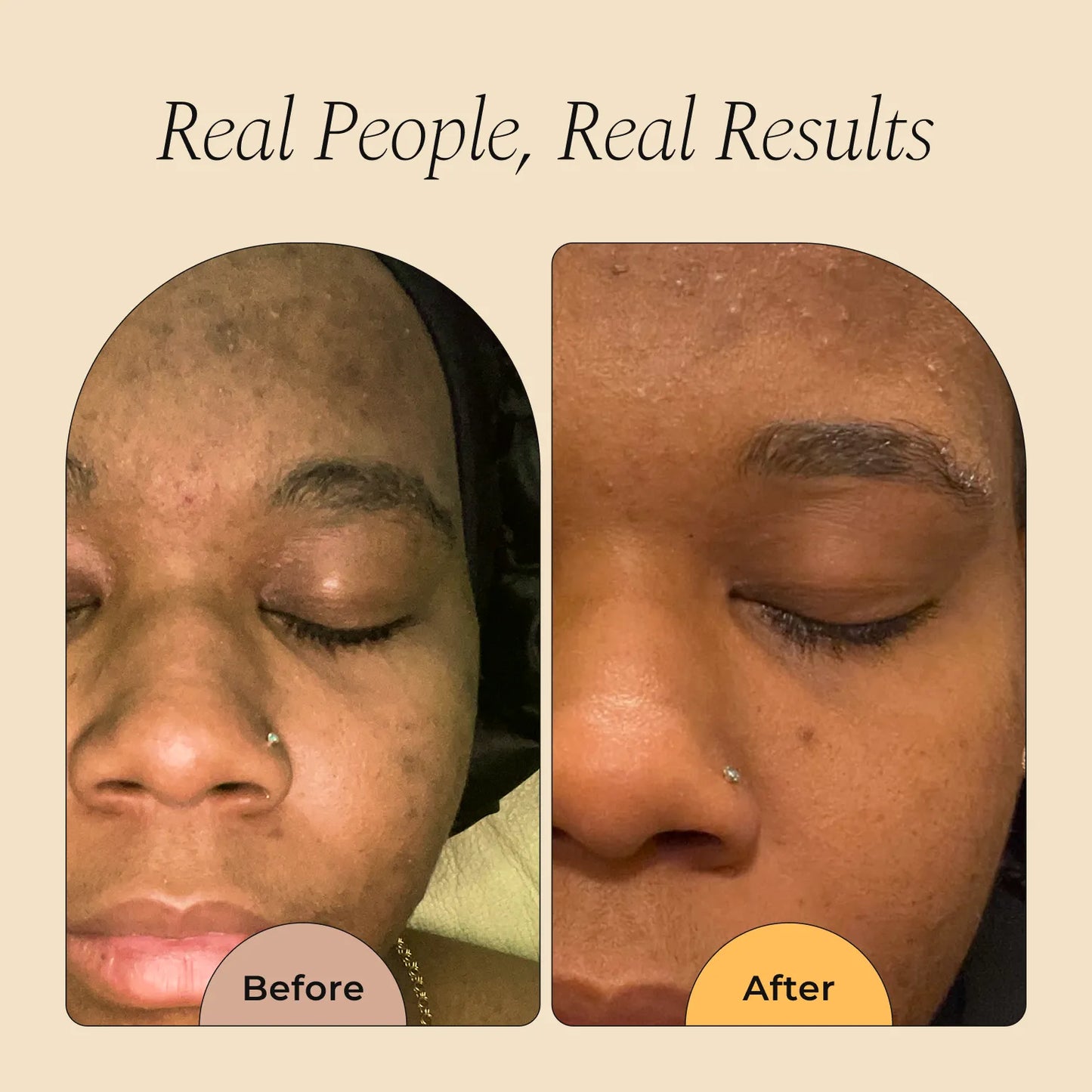 Turmeric Brightening Soap (with Vitamin C, Alpha Arbutin, Oat)