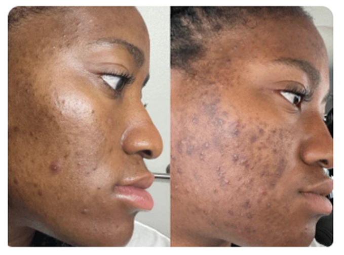 Before and After