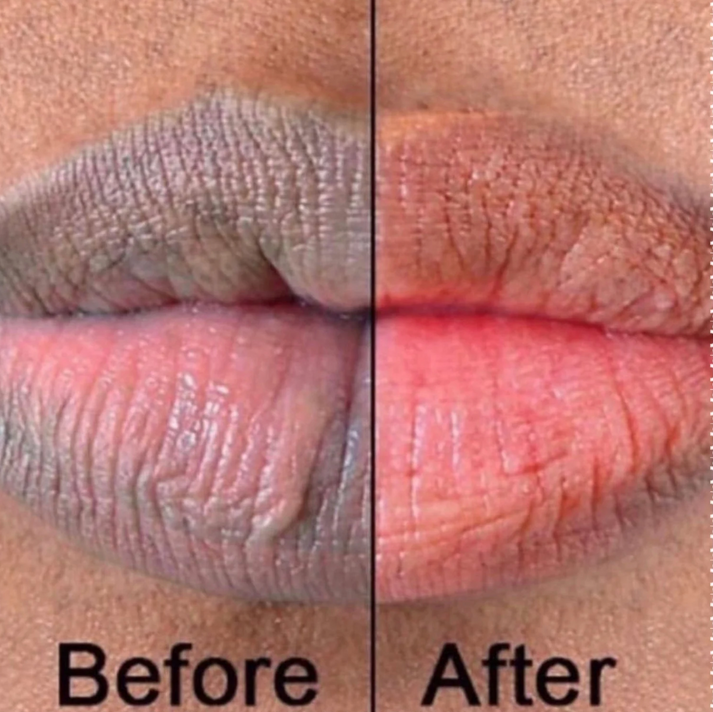 Turmeric and Lemon Lip Balm (for Dark Lips)N Glo Melanin
